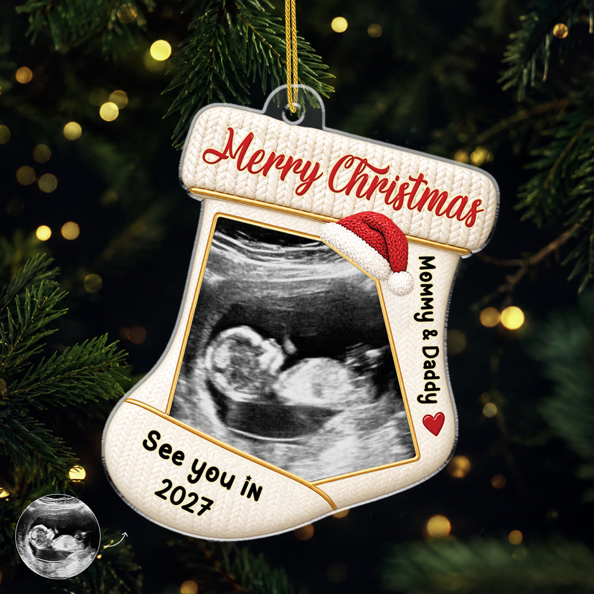 Ultrasound Photo Christmas Stocking Acrylic Ornament - Personalized Gifts for Parents-to-Be